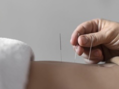 Lekarz: akupunktura nie leczy nowotworów, ale polepsza jakość życia