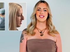 W programie Małgorzaty Rozenek-Majdan dostała nowy nos. "To był hardcore totalny, byłam gnębiona"