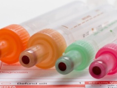 Zalecane przed operacją i w migotaniu przedsionków. Ocenią krzepliwość krwi