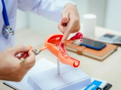 Endometrioza bez tajemnic. Dr Magdalena Biela o tym, jak działa KOS-Endo