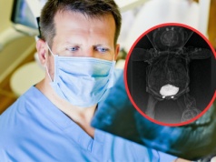 Pokazał RTG pluszowego misia swojej córki. "Cieniujące ciała obce"