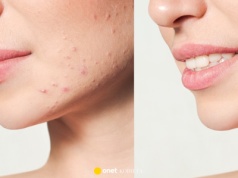 To serum ujarzmia hormony i stres. Są bez szans. Cera będzie matowa, gładka i bez grudek