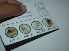 Naukowcy dotarli do najrzadszej grupy krwi. Płynie w żyłach tylko trzech osób. To może martwić