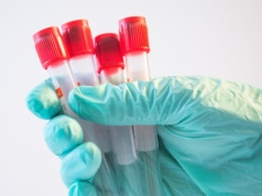 Pierwsze przypadki trądu od 44 lat. Objawy to nie tylko zmiany skórne