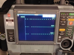 Liczyły się sekundy. Walka o życie mężczyzny na parkingu Leroy Merlin w Modlniczce