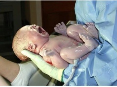 Piekło kobiet bez haseł, gdy na porodówce nie ma lekarza