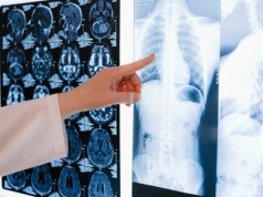 Otyłość i stan zapalny przyspieszają starzenie się płuc – nowe dane o ryzyku POChP