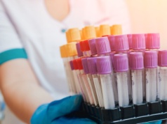 Dwa "nerkowe" wkaźniki z krwi, które wciąż mylimy. Wysoki poziom to zły znak