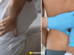 80 tys. Polaków umiera rok w rok. Choroba rozwija się po cichu, bez bólu