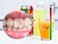 Cicha epidemia: popularne napoje dosłownie "rozpuszczają" zęby Polaków