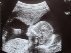 Co na to feministki? Wlk. Brytania: Selektywne aborcje dziewczynek