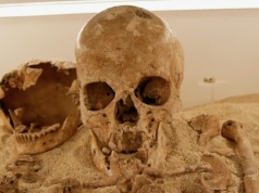 Choroba z paleolitu. Udało się zdiagnozować najstarszy przypadek choroby genetycznej