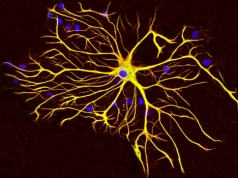 W Twoim mózgu krążą zombosomy. Mogą przyczyniać się do choroby Parkinsona