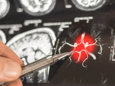 Będzie zmiana w leczeniu alzheimera? Jest już wniosek