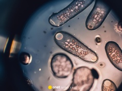 Nietypowe objawy zakażenia pasożytami. Lekarz wyjaśnia, na co zwrócić uwagę