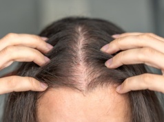 Cienkie i suche włosy? W tym wieku pasma już przestają się regenerować