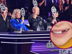 Znana gwiazda wybiła zęby! Miała wziąć udział w "Tańcu z Gwiazdami"