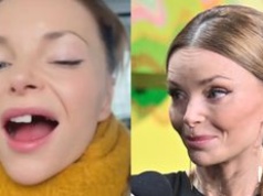 Dumna Izabella Miko prezentuje BRAKI W UZĘBIENIU: "Będę się bawić moim nowym lookiem" (FOTO)