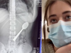 Niewiarygodne, co połknęła, gdy jadła jogurt. "Czułam, jak się przemieszcza"