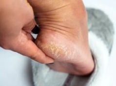 Kosztuje 15 zł. Hit z apteki na suche pięty