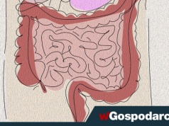 Po kolonoskopii warto zadbać o... probiotyki