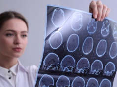 W kilka sekund diagnozuje choroby mózgu. "Jak ChatGPT dla medycyny"