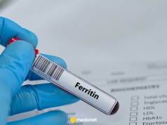 Kiedy poziom ferrytyny jest za niski? Diagnostka wyjaśnia