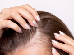 Włos się jeży - problemy na głowie