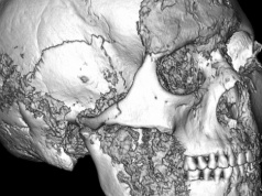 Starożytni chirurdzy z Ałtaju. W dalekiej Azji wykonywano skomplikowane operacje