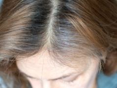 Przełom w walce z siwizną. Nie tylko farba zmienia kolor. Dzięki tej witaminie włosy ciemnieją