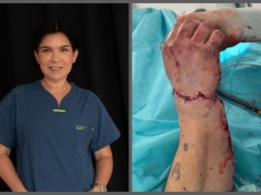 Miała dzień wolny, uratowała przyniesioną w worku odciętą dłoń. Znów o lekarce z Limanowej mówi cała Polska