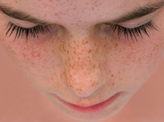 Jak powstają piegi? Najlepsze sposoby na usuwanie piegów na twarzy i zapobieganie ich powstawaniu