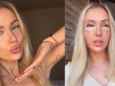 Eliza Trybała poddała się PLASTYCE POWIEK! Zainspirowała się znaną koleżanką: "Miała dokładnie ten efekt, który chciałam uzyskać"