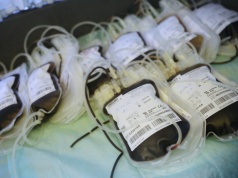 W Sandomierzu można wesprzeć pacjentki chore na nowotwory