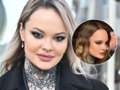 Monika Miller poprawiła sobie twarz. Pokazała się po zabiegu "tygrysiego liftingu"