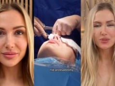 Eliza Trybała relacjonuje wizytę w klinice, w której sprawiła sobie PLASTYKĘ POWIEK: "Jestem trochę OSZOŁOMIONA"