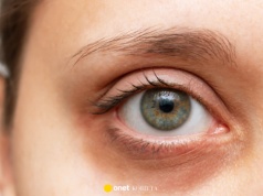 Ten krem z peptydem miedziowym wybiela cienie pod oczami jak laser! Hit