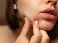 To "siedlisko bakterii" codziennie dotyka twarz. Efekt? Trądzik i stany zapalne