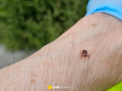 Ukąszenie kleszcza może wywołać alergię pokarmową