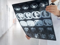 5 lat wystarczyło, by całkowicie cofnąć marskość wątroby. Jedna zmiana