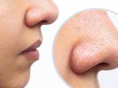 Ten peeling wyciąga zaskórniki jak odkurzacz! Pozbądź się w końcu czarnych kropek z nosa
