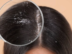 Ten szampon to likwidator łupieżu! Błyskawicznie pozbędziesz się białych płatków