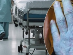 Obudził się niebieski, zszokował lekarzy. To nie problemy z krążeniem