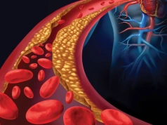 Cholesterol, czyli cichy zabójca. Eksperci obalają najgroźniejsze mity