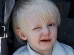 Dlaczego dzieci chorują na wiosnę? Nieważne, że jest cieplej