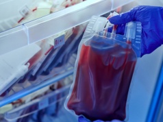 Ta grupa krwi zwiększa ryzyko udaru. Naukowcy wyjaśnili przyczynę