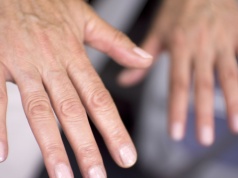 Ten objaw łatwo zlekceważyć. Drżenie rąk może mieć kilka ukrytych przyczyn