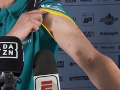 Skandal po rundzie MŚ w Brazylii. Zawodnicy pokazali obrażenia