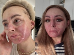 Ten grill pod Włodawą zmienił życie tiktokerki na zawsze. Zapewnia, że żadnych mediacji nie będzie