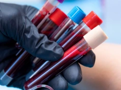 Pobierała im krew do badań i nic o tym nie wiedzieli? Skandal w polskim szpitalu